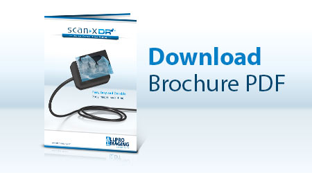 ScanX DR Sensor - Download brochure PDF